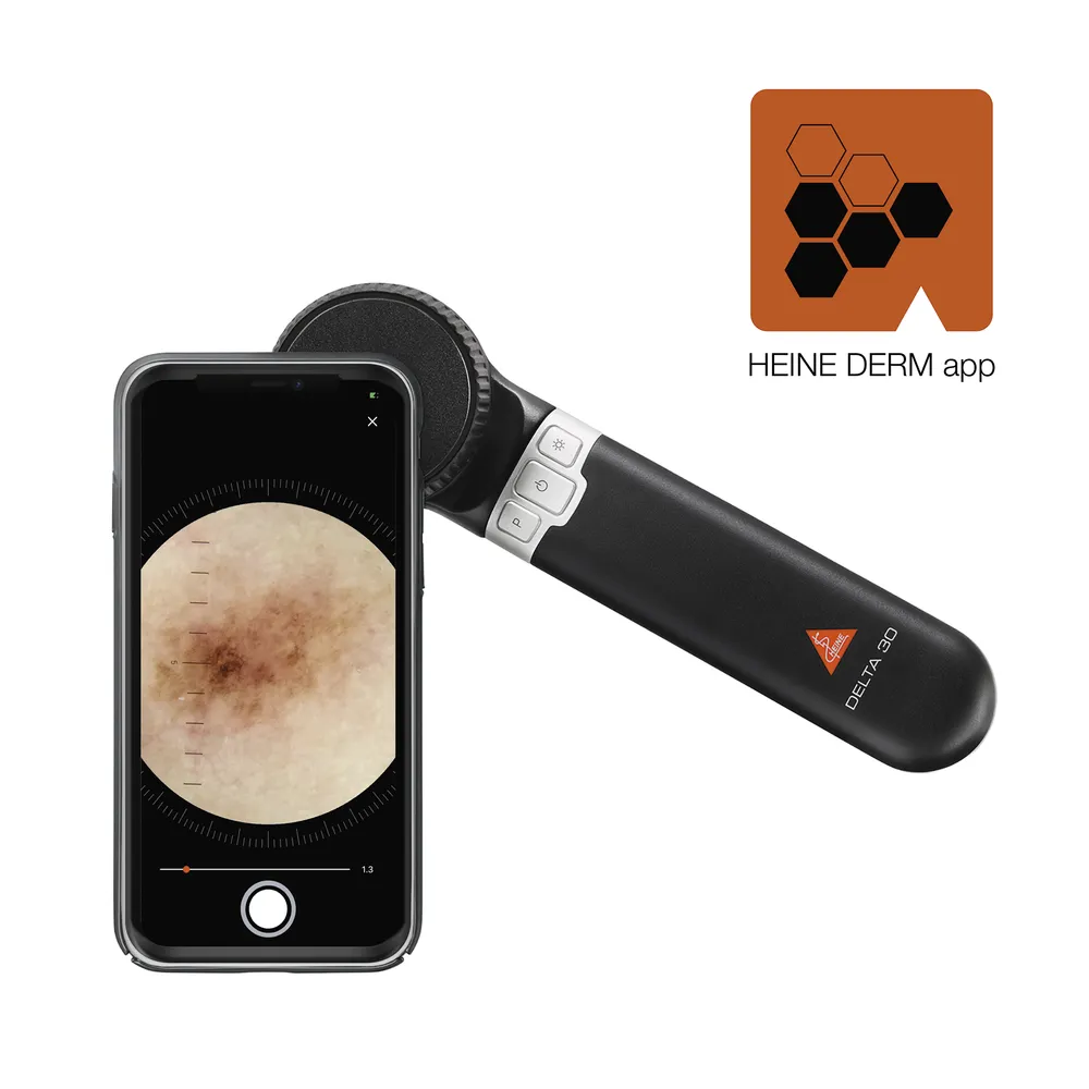 csm_k-000.00.001-heine-dermatoscope-derm-app-delta-30_en_gb_additional_1f44c05a6b.webp