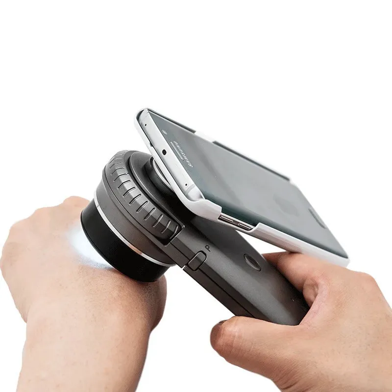pince-universelle-telephone-pour-dermatoscope-illuco (4).webp