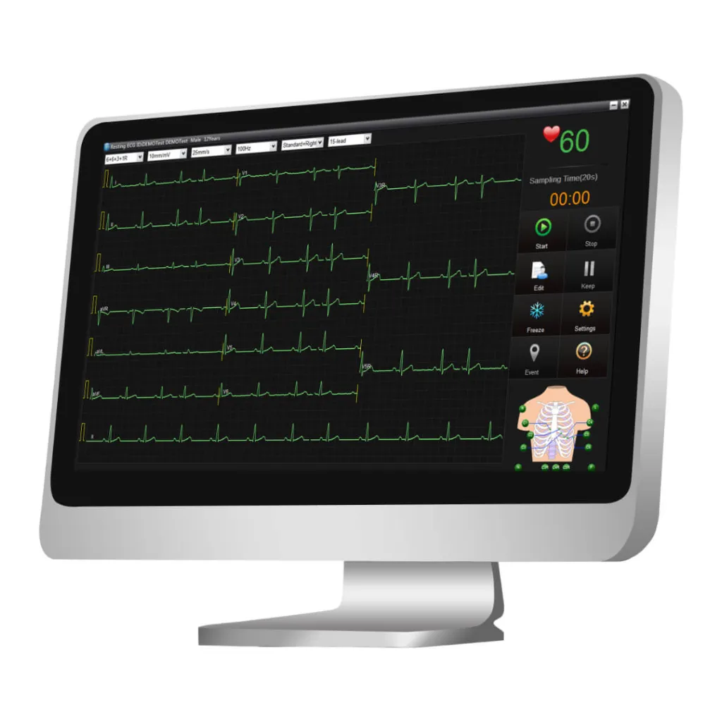 303203-0-super-edan-se-1515-ekg-datenmanagement-software-3WQrVhfWi1qisF.webp