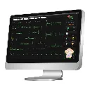 303203-0-super-edan-se-1515-ekg-datenmanagement-software-3WQrVhfWi1qisF.webp