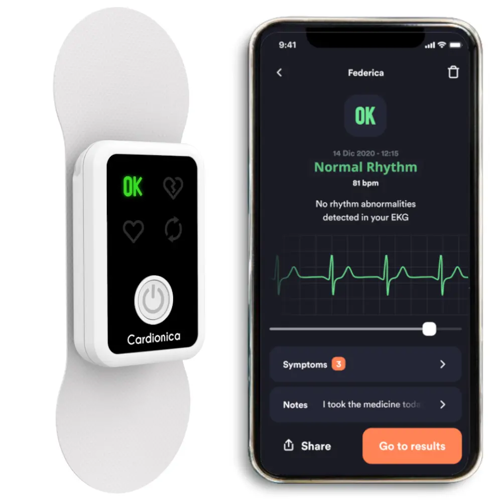 electrocardiograf-cardionica-ecg-1-afib-bluetooth_2.webp