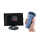 echographe-portable-couleur-edan-nano (2).webp