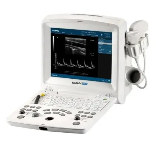 [EDANDUS60] Echographe portable EDAN DUS60